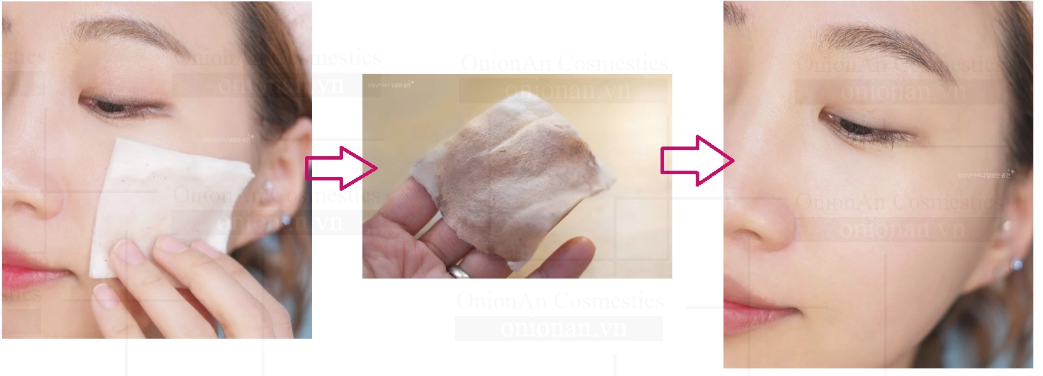 Nước Tẩy Trang La Roche-Posay Micellar Water Ultra Oily Skin 